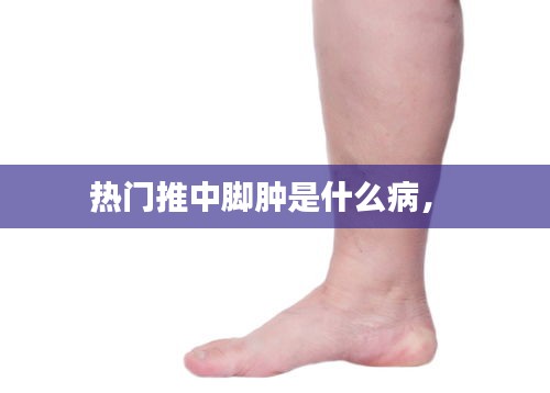 熱門推中腳腫是什么病， 