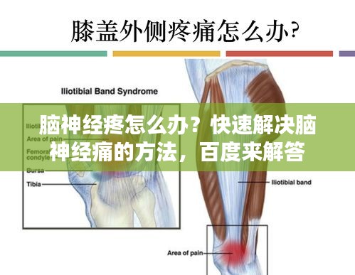 腦神經(jīng)疼怎么辦？快速解決腦神經(jīng)痛的方法，百度來解答